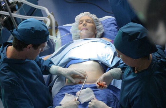 Trečiasis „Grožio peilio“ sezonas 