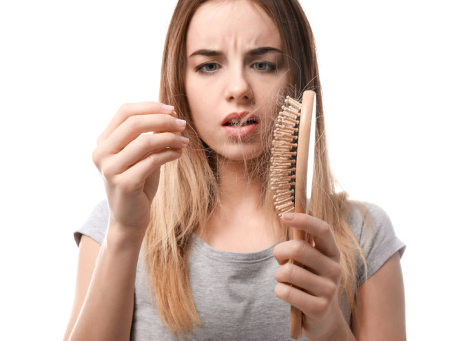 Plaukų slinkimas, slenkantys plaukai / Shutterstock nuotr.