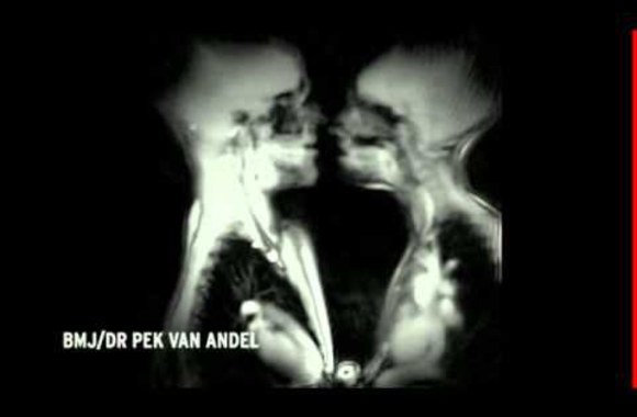 VIDEO kadras: Eksperimentas: seksas magnetinio rezonanso aparate