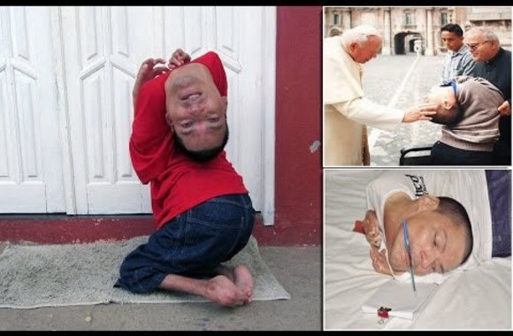 VIDEO kadras: Brazilian man born with his head UPSIDE DOWN but fought a determined struggle for independence