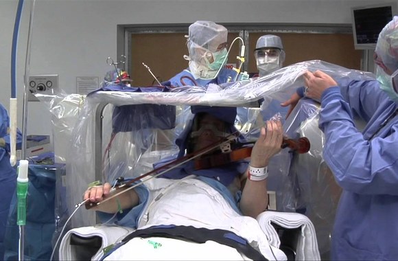 VIDEO kadras: Violinist Still Making Music After DBS Surgery - Mayo Clinic