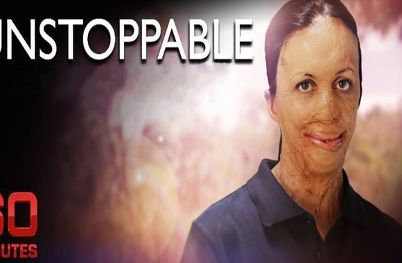 VIDEO kadras: Turios Pitt gyvenimas po gaisro