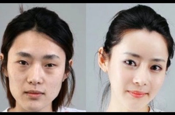 VIDEO kadras: Prieš ir po plastinių operacijų Pietų Korėjoje