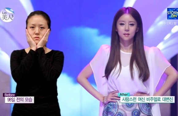 VIDEO kadras: Plastinių operacijų rezultatai