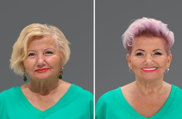 Joana Bartaškienė. Prieš ir po / Tado Mikštavičiaus nuotr.

