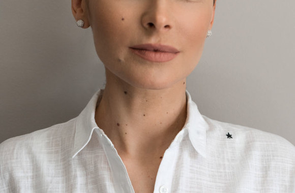 Agnė Jagelavičiūtės išbandė apgamų šalinimo lazeriu procedūrą