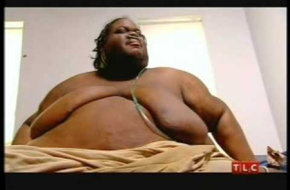 VIDEO kadras: Labai didelį antsvorį turintys žmonės