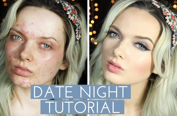 em-ford-demonstruoja-kaip-paslepti-akne