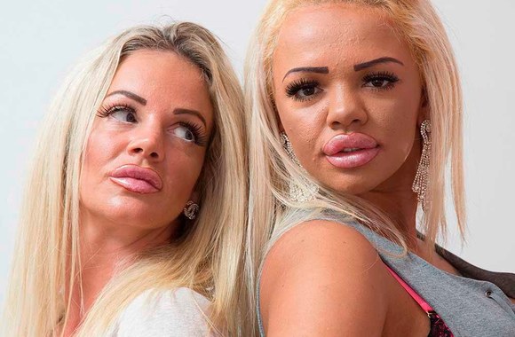 plastic-surgery-mother-and-daughter-i-let-my-daughter-strip-to-fund-our-addiction