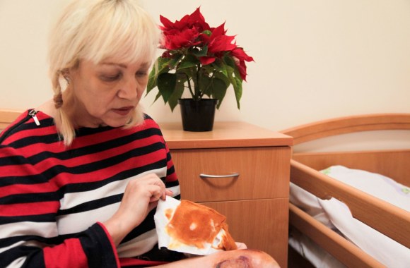 Romos Mačiulytės sužalota koja