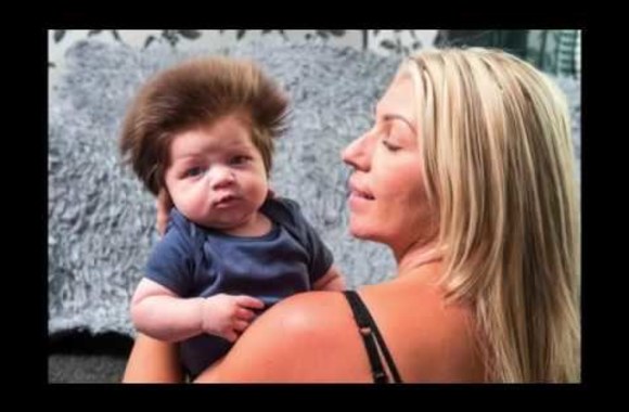 ispudinga-kudikio-sukuosena