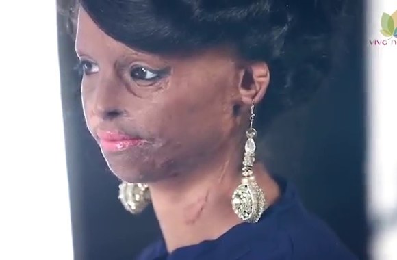 face-of-courage-breaking-the-barriers-of-victimism