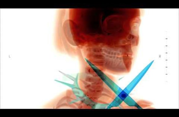 VIDEO kadras: Mados infekcija / 2015 pavasaris / vaizdo klipas