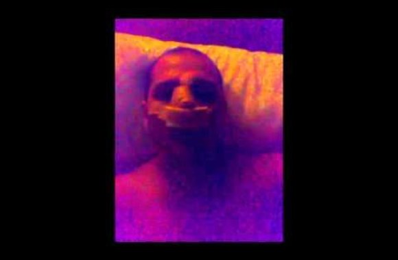 soliaris-4-ios-valanos-po-nosies-plastines-operacijos